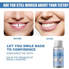 Load image into Gallery viewer, Moldable False Teeth for Temporary Tooth Fillings