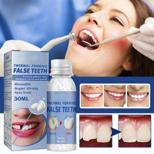 Load image into Gallery viewer, Moldable False Teeth for Temporary Tooth Fillings